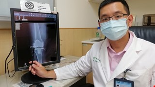 ROSA機器手臂人工關節置換 結合健保治療膝關節