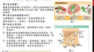 認識腹腔鏡膽囊切除術