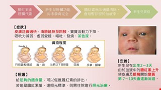 新生兒黃疸是什麼