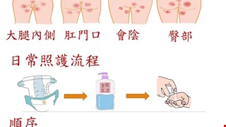 失禁性皮膚炎