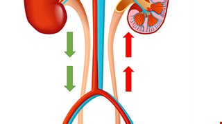 Vesicoureteral Reflux in Children 兒童膀胱輸尿管尿逆流