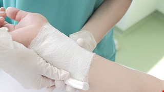 Cellulitis 蜂窩組織炎