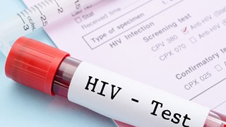 AIDS 愛滋病Q&A