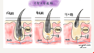 除毛雷射