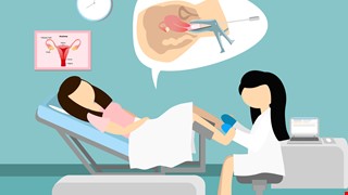 Cervical Cancer 子宮頸抹片及子宮頸癌