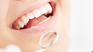 Silver Diamine Fluoride (SDF): What You Should Know 氟化氨銀（SDF）治療注意事項