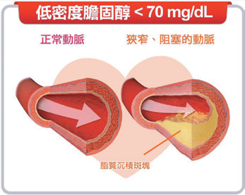 圖1：冠狀動脈疾病患者低密度膽固醇指引