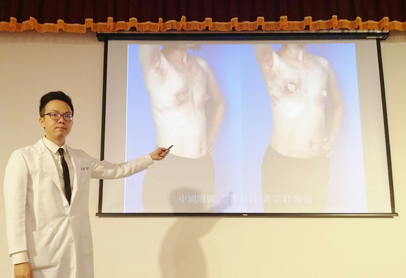 中國附醫整形外科 黃宗君醫師：平胸乳癌患者新福音 內視鏡全乳房切除及內視鏡闊背肌皮瓣重建手術