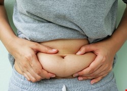 月經遲到人又爆肥？ 原來是多囊性卵巢症候群作祟