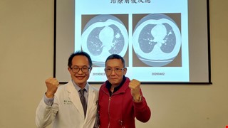 合併化療及免疫治療 肺腺癌治療新選擇