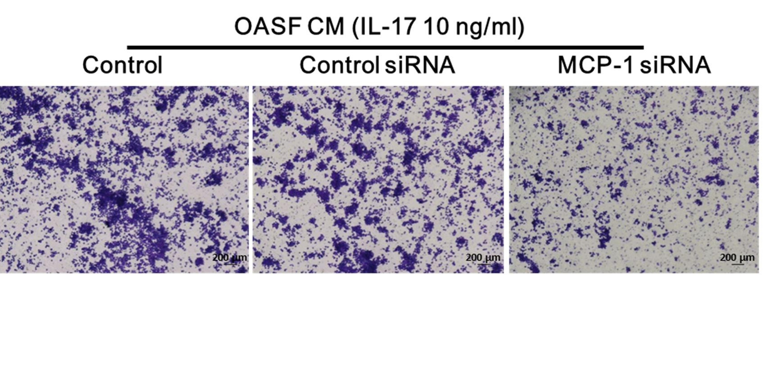 MCP-1 controls IL-17-promoted monocyte migration and M1 polarization in osteoarthritis img