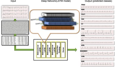 Usefulness of Machine Learning Based Detection and Classification of Cardiac Arrhythmias with 12 Lead Electrocardiograms img