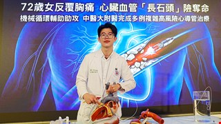 72歲女反覆胸痛 心臟血管「長石頭」險奪命 機械循環輔助助攻 中醫大附醫完成多例複雜高風險心導管治療案例