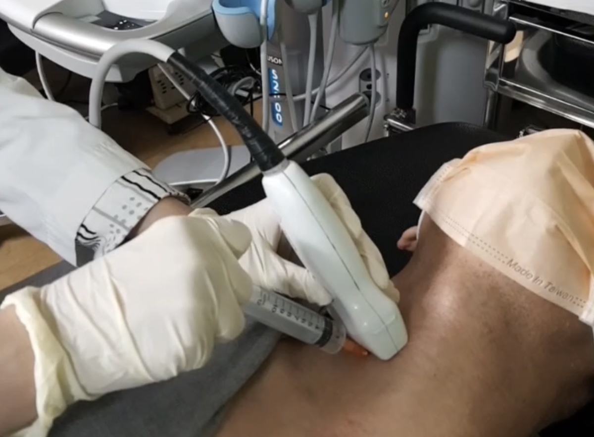 甲狀腺結節細針穿刺之甲狀腺癌基因篩檢